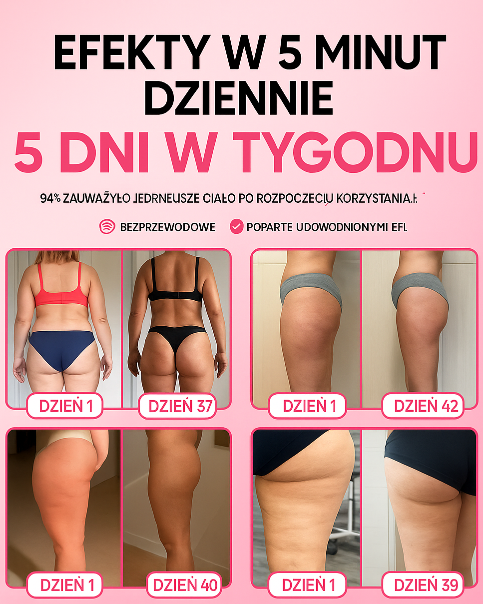 SheVitality™ – Masażer Antycellulitowy z Efektem Liftingu
